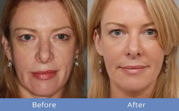 Tại sao quảng cáo facebook không được phê duyệt? Giải đáp 4 Tại sao quảng cáo facebook không được phê duyệt